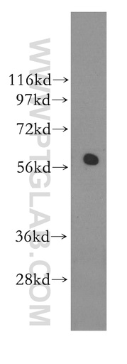 [11364-1-AP-20UL] RAD23A Polyclonal antibody