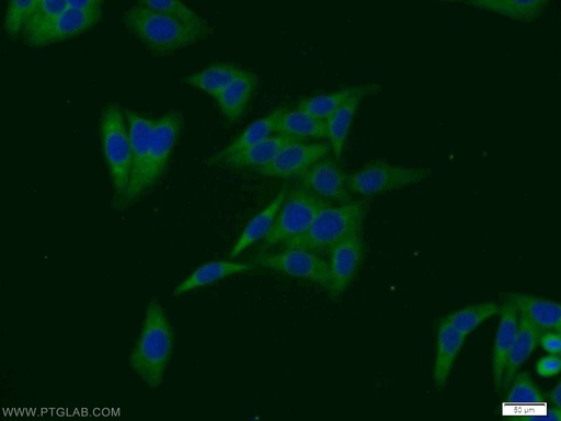 [11376-1-AP-20UL] SULT1A4 Polyclonal antibody