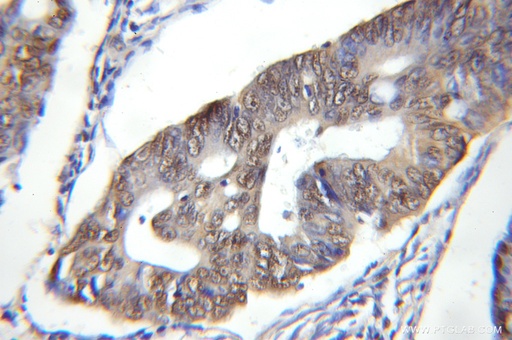 [11380-1-AP-150UL] DDB1 Polyclonal antibody