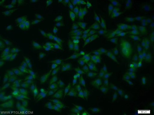 [11383-1-AP-150UL] SPRY2 Polyclonal antibody