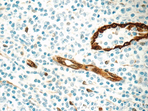 [11386-1-AP-150UL] ACKR2 Polyclonal antibody