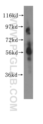 [11388-1-AP-20UL] CHRNA6 Polyclonal antibody