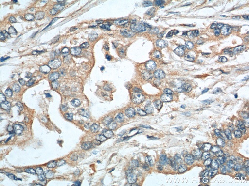 [11391-1-AP-150UL] EPCR Polyclonal antibody
