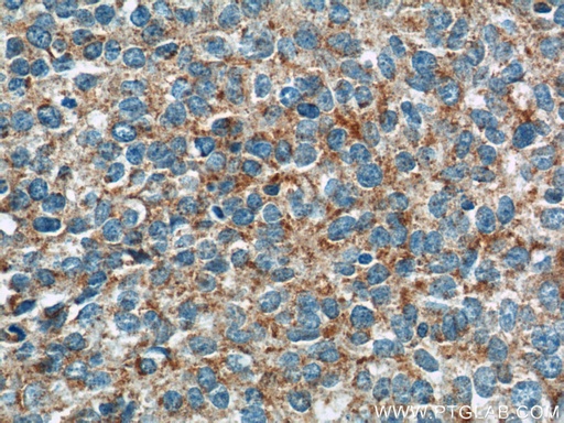[11395-1-AP-150UL] GKAP1 Polyclonal antibody
