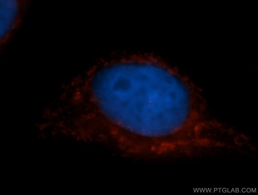 [11411-2-AP-20UL] COX7C Polyclonal antibody