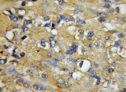 [11413-1-AP-150UL] COX7A1 Polyclonal antibody
