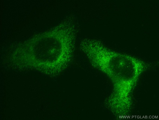 [11423-1-AP-20UL] EIF3M Polyclonal antibody