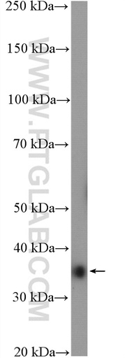 [11427-1-AP-150UL] ANKRD1 Polyclonal antibody