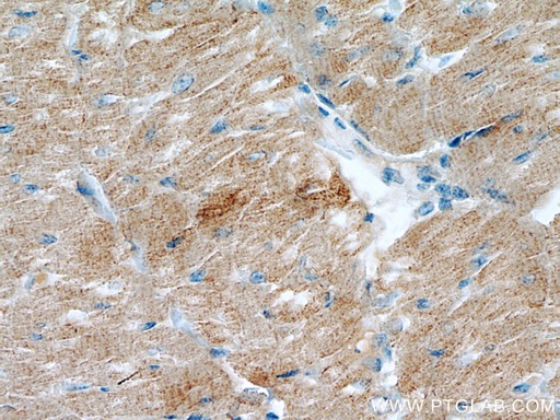 [11450-1-AP-20UL] Myozenin 2 Polyclonal antibody