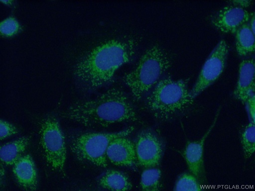 [11460-1-AP-150UL] COX6A1 Polyclonal antibody