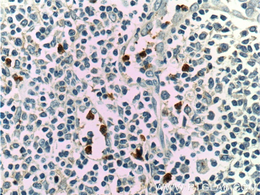 [11461-1-AP-20UL] LILRA2 Polyclonal antibody