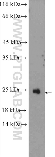 [11466-1-AP-150UL] RAX2 Polyclonal antibody