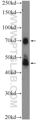 [11476-1-AP-150UL] TRIM5 Polyclonal antibody