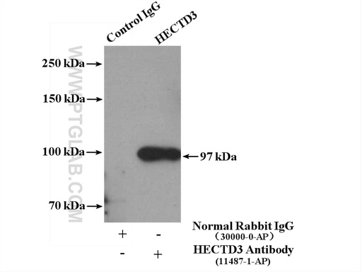 [11487-1-AP-20UL] HECTD3 Polyclonal antibody