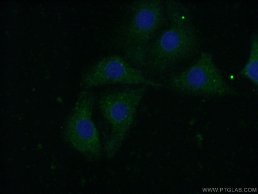 [11490-2-AP-150UL] CAPS1 Polyclonal antibody