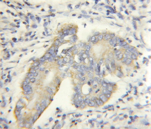 [11491-1-AP-150UL] PHACS Polyclonal antibody
