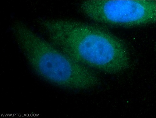 [11495-1-AP-150UL] FGF18 Polyclonal antibody