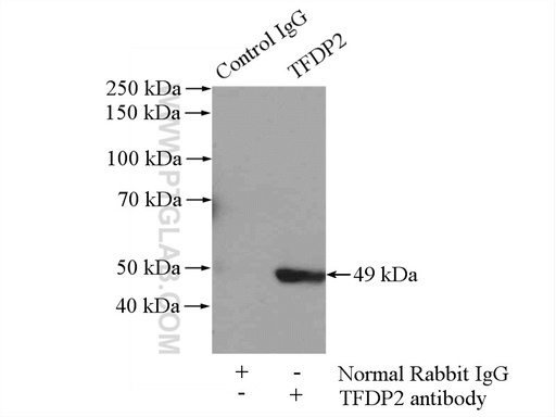 [11500-1-AP-20UL] TFDP2 Polyclonal antibody