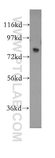 [11505-1-AP-20UL] MED17 Polyclonal antibody