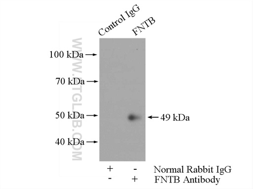 [11507-1-AP-20UL] FNTB Polyclonal antibody