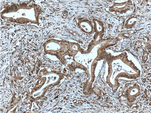 [11508-1-AP-150UL] PTP4A1/PRL1 Polyclonal antibody