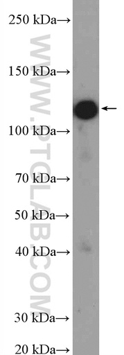 [11513-1-AP-150UL] PHF15 Polyclonal antibody