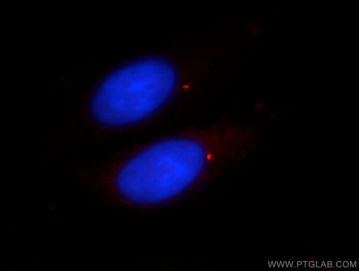 [11517-1-AP-20UL] CENPJ Polyclonal antibody