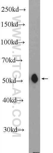 [11518-1-AP-150UL] MFSD10 Polyclonal antibody