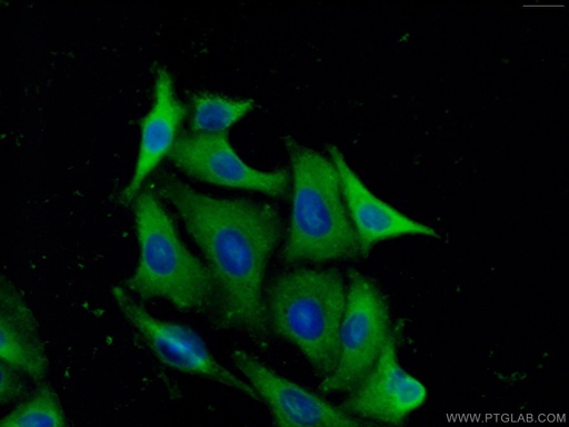 [11536-1-AP-20UL] PREP Polyclonal antibody