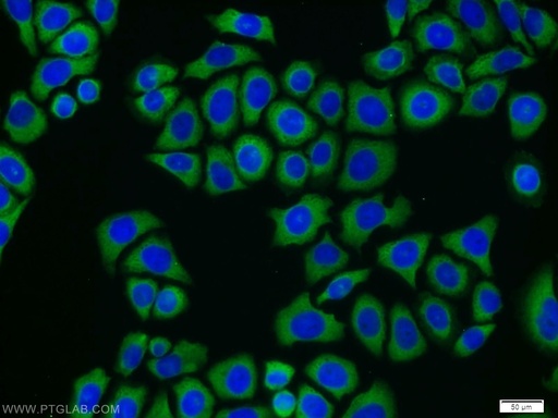 [11549-1-AP-150UL] CAMKK2 Polyclonal antibody