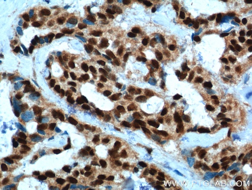 [11555-1-AP-20UL] PYGO2 Polyclonal antibody