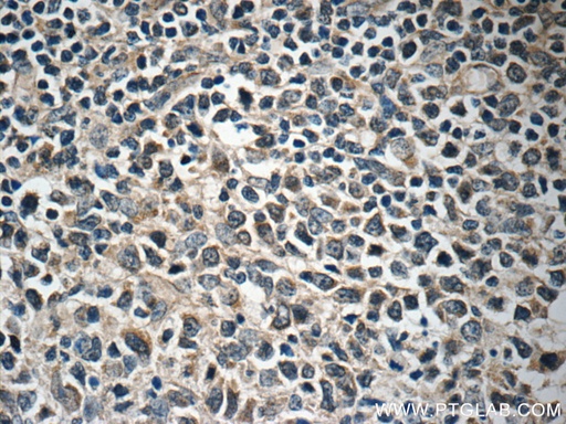 [11556-1-AP-20UL] FBXL18 Polyclonal antibody