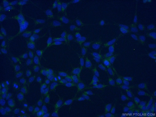 [11559-1-AP-20UL] AGTRAP Polyclonal antibody