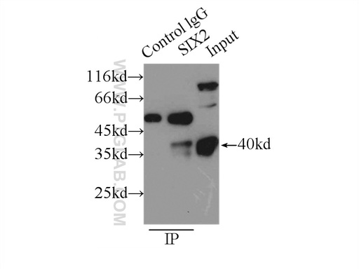 [11562-1-AP-20UL] SIX2 Polyclonal antibody