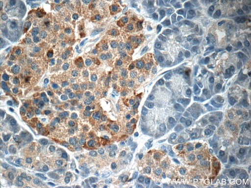 [20696-1-AP-20UL] SSTR3 Polyclonal antibody