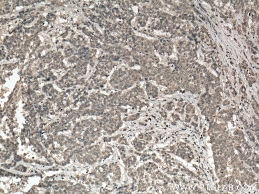 [66601-1-IG-20UL] PALLD,palladin Monoclonal antibody