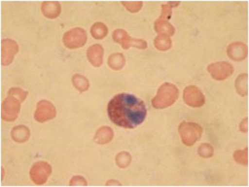 Giemsa stain [TC232]