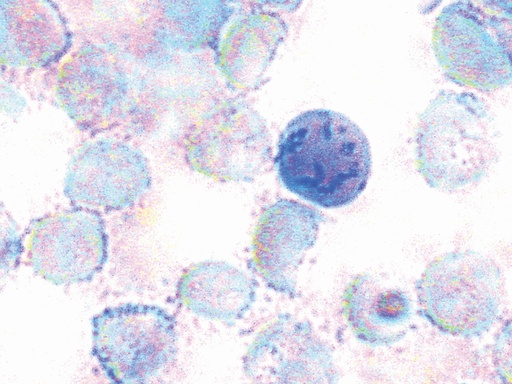 [TCL115-100ML] Reticulocyte Staining Solution     